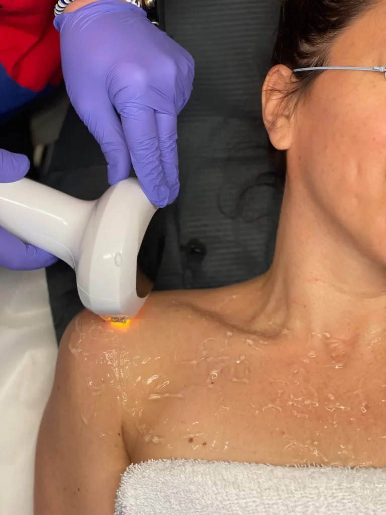 Portfolio 1 Skin Brightening